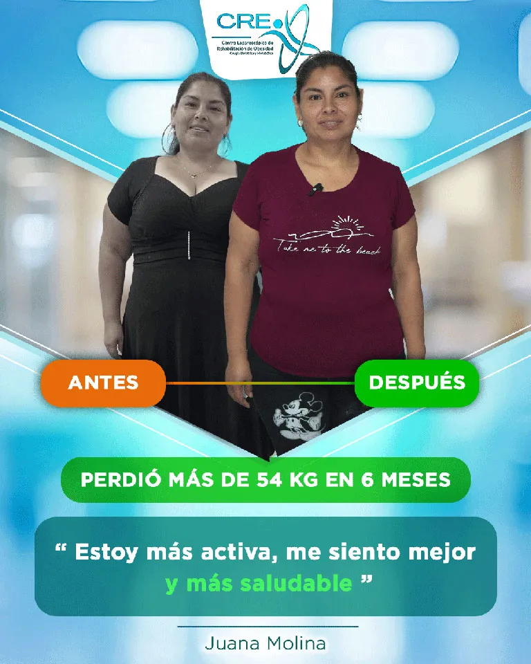 jUANA-aNTES-Y-DEPUÉS